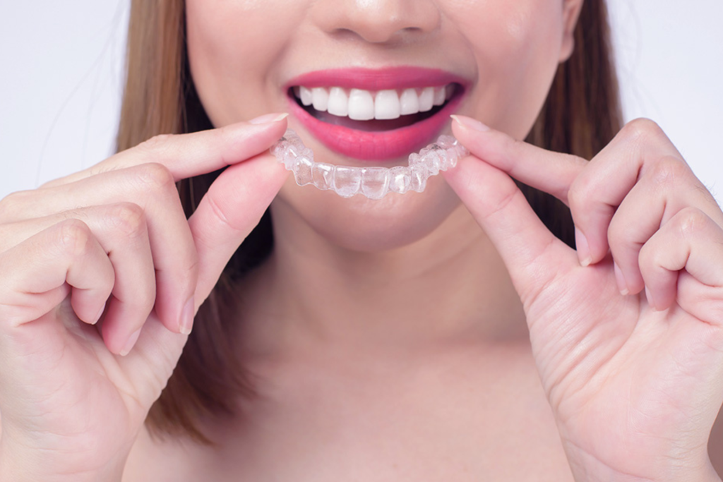 Aparelhos Invisíveis Invisalign